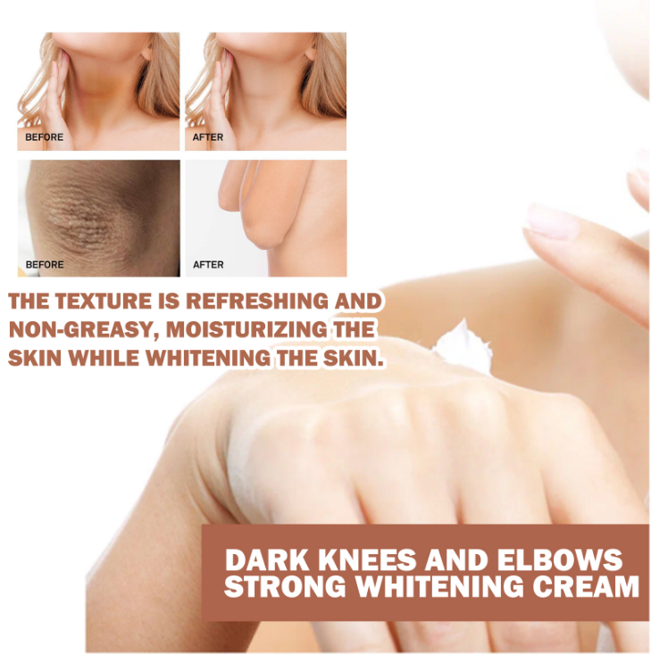 Eelhoe Dark Knees and Elbows Strong Whitening Cream - 50g
