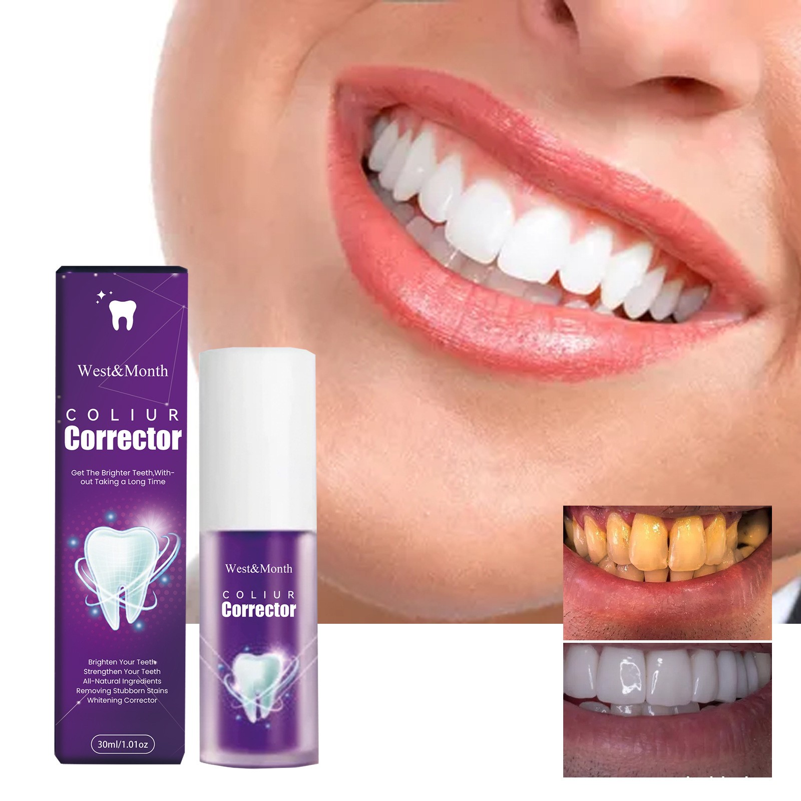 West&Month Coliur Teeth Whitener Corrector – Brighten Your Smile in Minutes