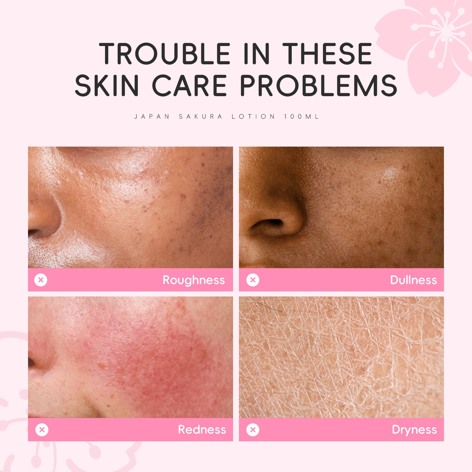 Dr. Roséva Japan Sakura Face Lotion