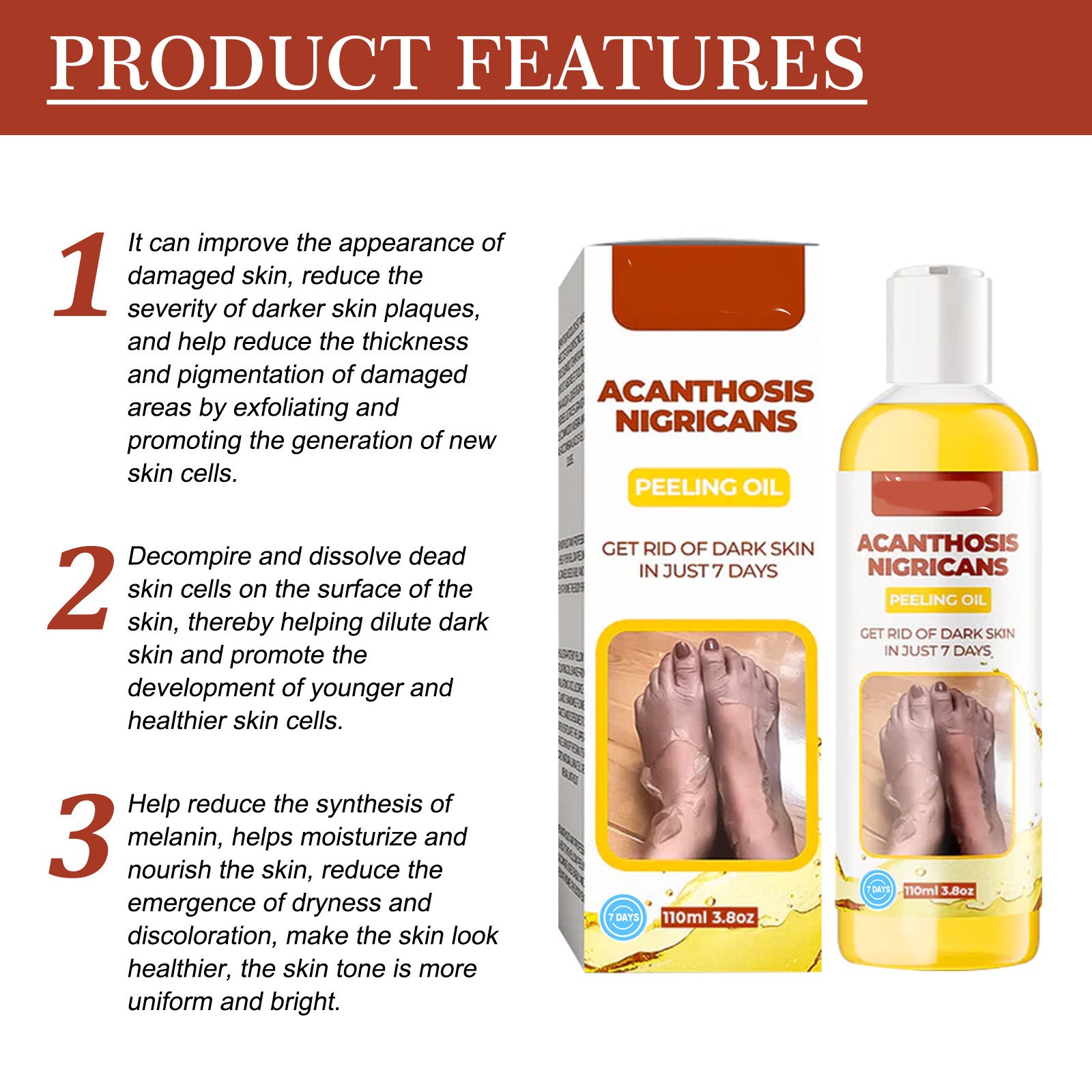 Acanthosis Nigricans Peeling Oil – Remove Dark Skin in Just 7 Days