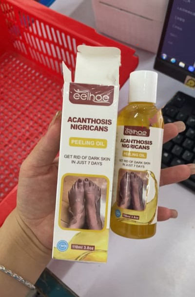 Acanthosis Nigricans Peeling Oil – Remove Dark Skin in Just 7 Days