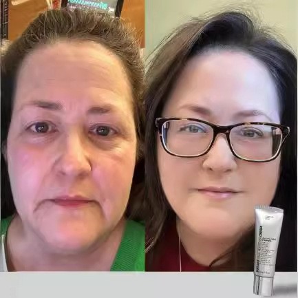 Instant Eye Tightener