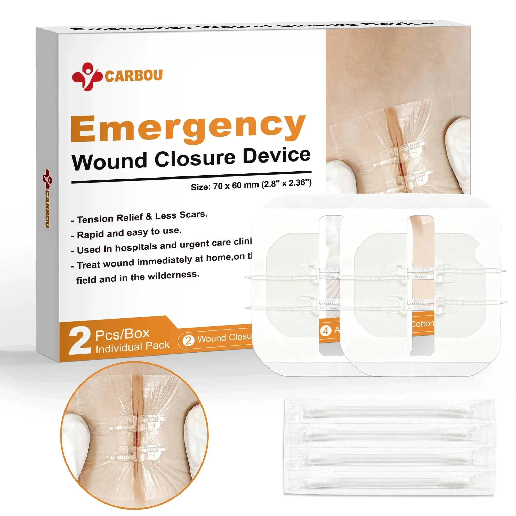 Wound Closure Device