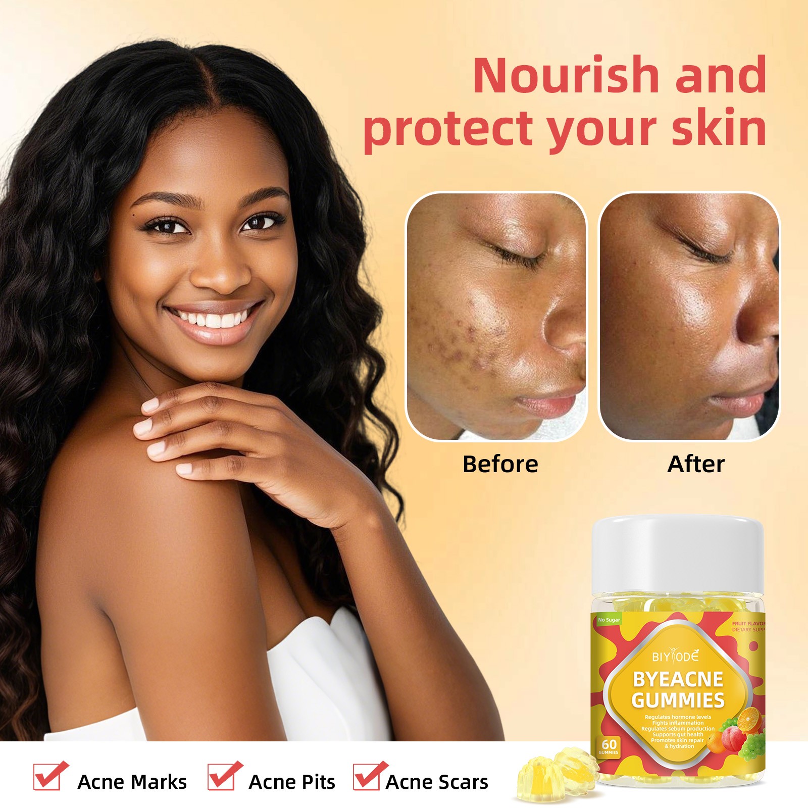 ByeAcne Gummies – Sugar-Free Daily Skin Support from Within