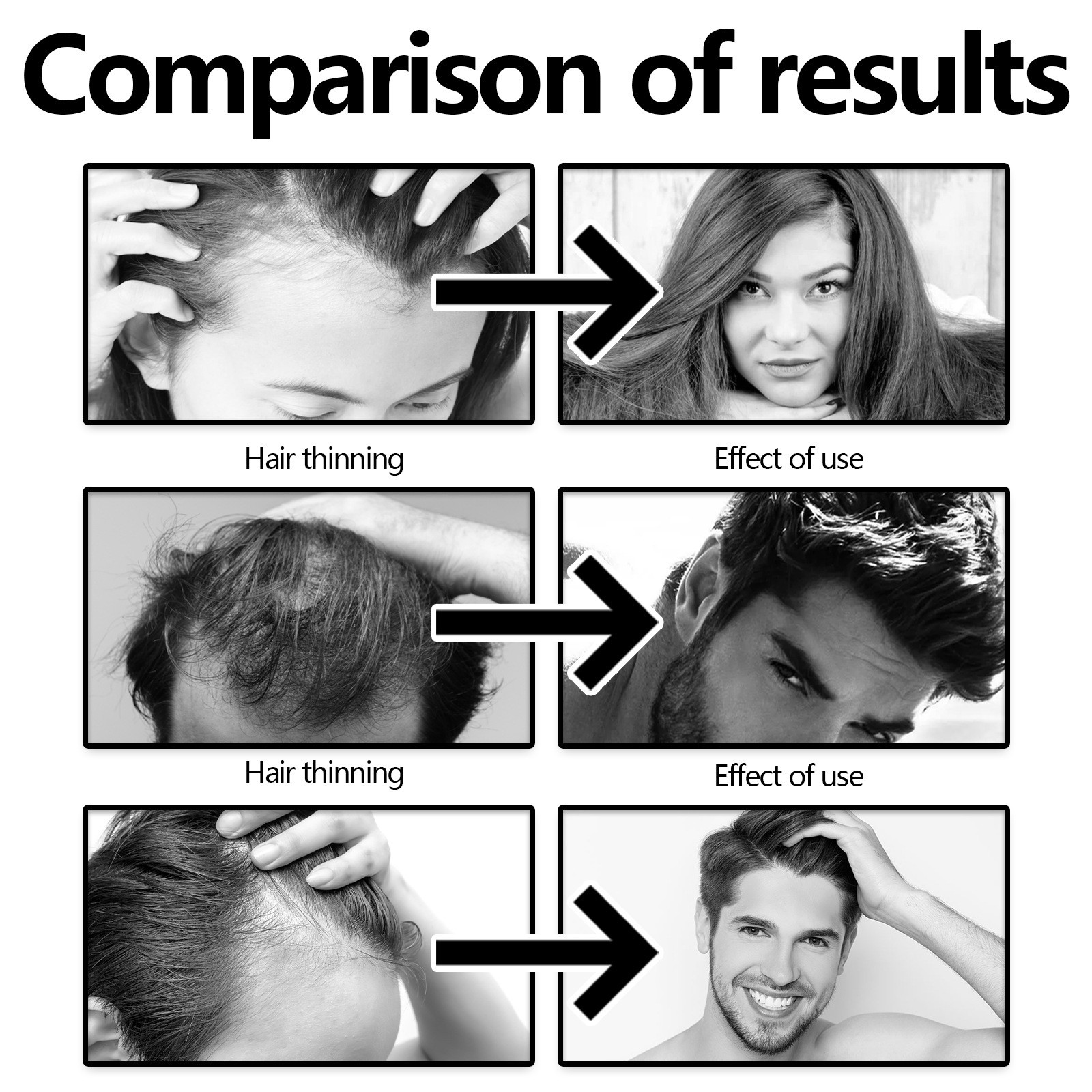 West Month Follicle Repair Hair Regrowth Drops