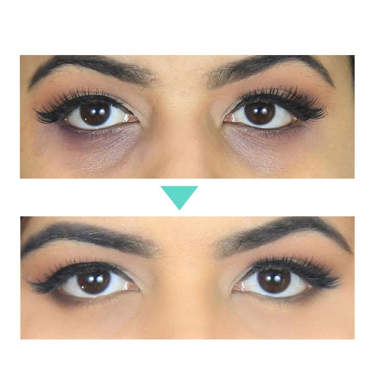 AnYi Beauty Eye Cream – Target Dark Circles, Puffiness, and Fine Lines