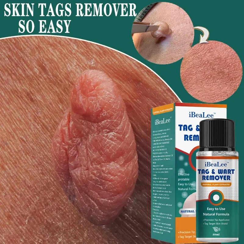 iBeaLee™ Tag & Wart Remover