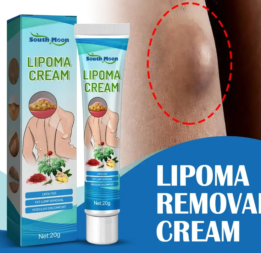 Lipoma Removal Cream