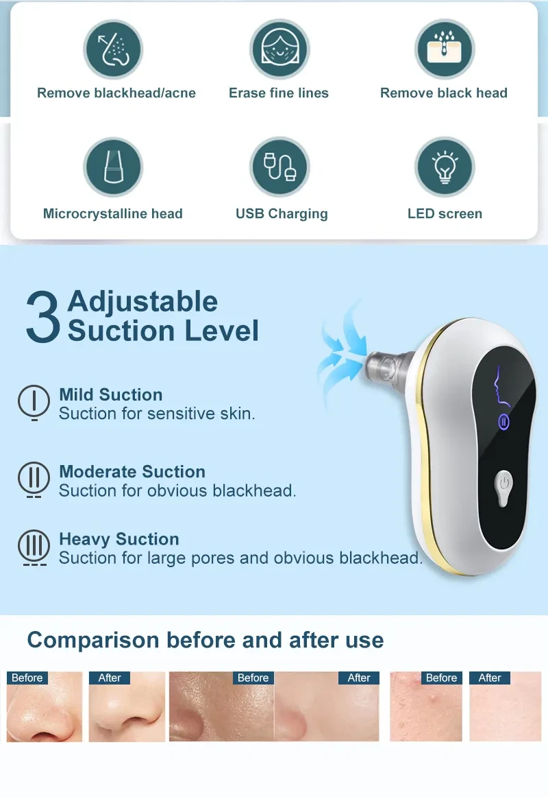 Suction Blackhead Remover Kit Electric Facial Pore Cleanser Acne Cleaner