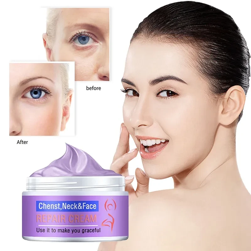 Whitening Cream For Dark Skin