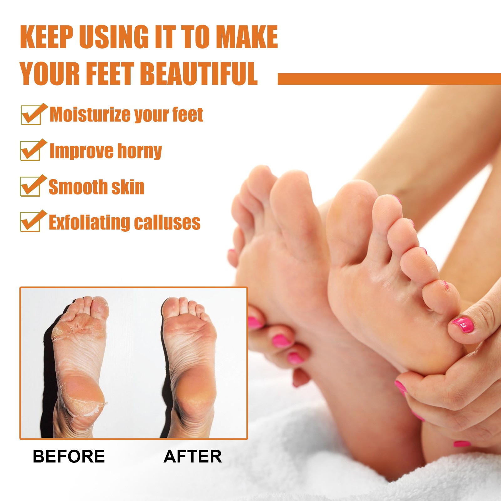 Foot Callus Removal Spray GFOUK™