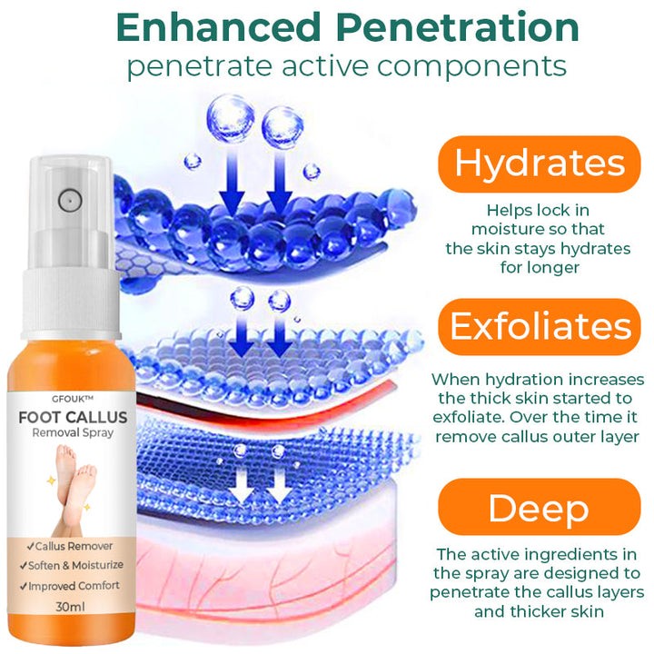 Foot Callus Removal Spray GFOUK™