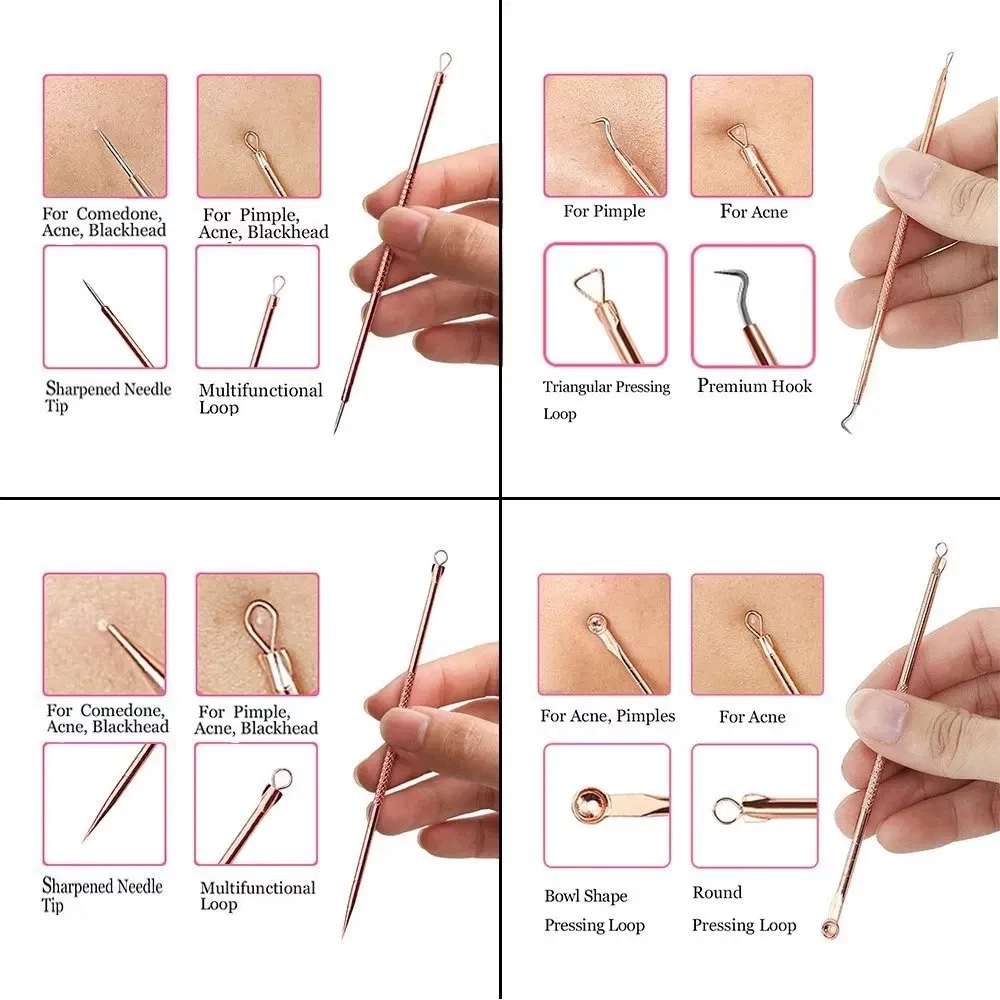 Color: WHITE - 4PCS Stainless Steel Acne Needle Electroplating Colorful Rose Gold Acne Needle Extrusion Blackhead Tool Can Be Customized LOGO