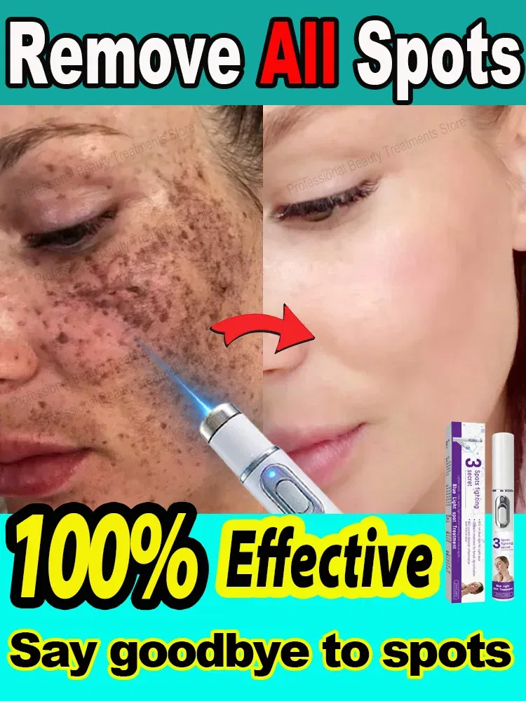 Color: green - ?…?«𝐞𝐜?¤𝐥𝐞 ?«𝐞?¦𝐨𝐯𝐚𝐥 Laser Therapy to Heal Spots