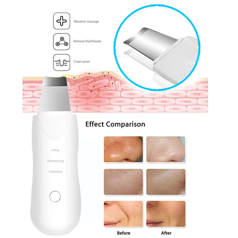 Color: green - Ultrasonic Skin Scrubber Scrubber Deep Vibrate Facial Cleaner Shovel Face Scrubber Peeling Black Head Remover Facial Massager