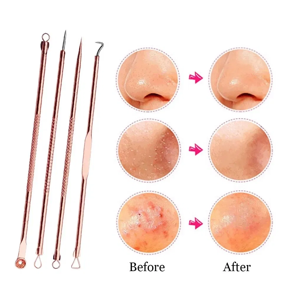 Color: Silver - 4PCS Stainless Steel Acne Needle Electroplating Colorful Rose Gold Acne Needle Extrusion Blackhead Tool Can Be Customized LOGO