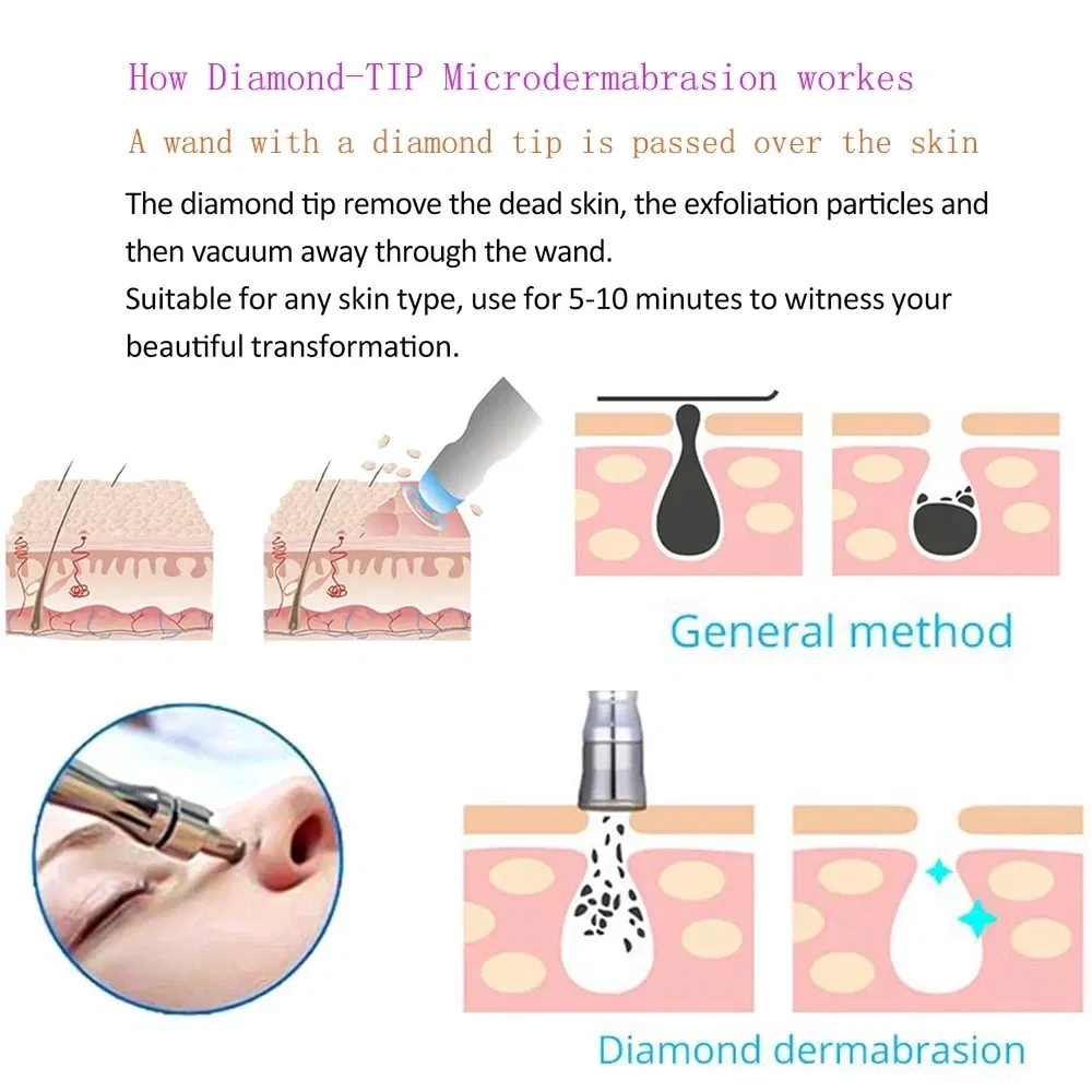 Color: Gold, Ships From: CN, Power Source: AU - Microdermabrasion Facial Diamond Dermabrasion Machine Portable Blackhead Acne Pore Cleaning Beauty Device Rejuvenation Peeling