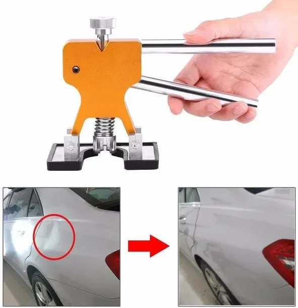 Dent Removal Kit