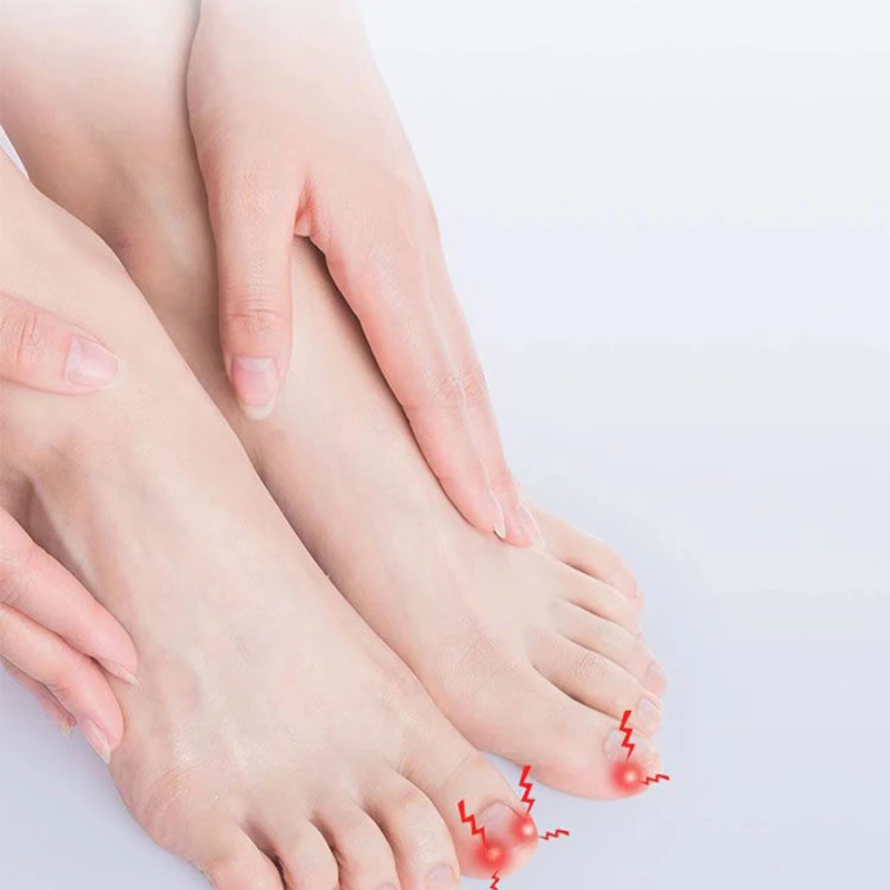 Ingrown Toenail Corrector Tools Pedicure Recover Embed Toe Nail Treatment Professional Ingrown Toenail Correction Foot CareTool