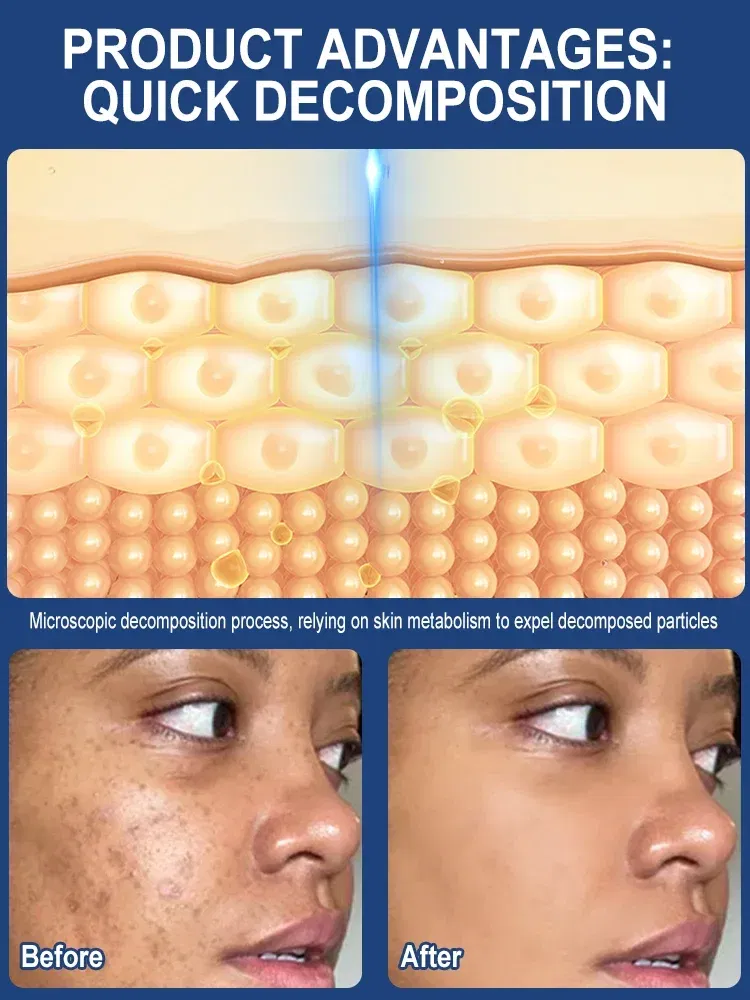 Color: black - ?…?«𝐞𝐜?¤𝐥𝐞 ?«𝐞?¦𝐨𝐯𝐚𝐥 Laser Therapy to Heal Spots
