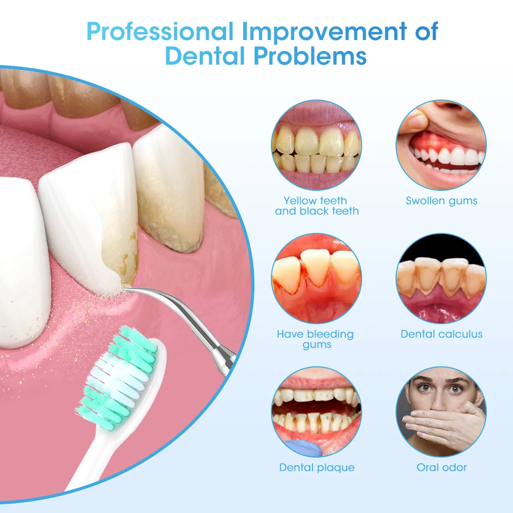 Color: Beige - Dental Calculus Removal Electric Teeth Whitening & Cleaning Ultrasonic Tooth Cleaner Scaler Plaque Coffee Stain Tartar Oral Care