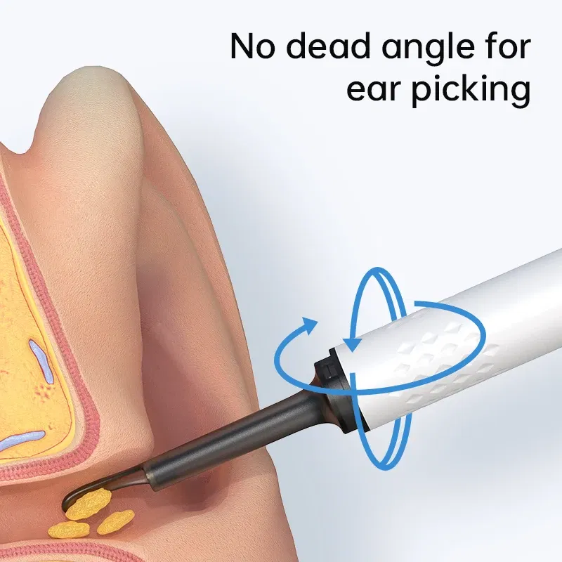Color: Ivory - Visual Ear Cleaner With Camera 6 LED Lights 4.0mm Lens Ear Wax Removal Tool ?‹500W Pixel Camera Take Video 500W HD Earpick Gifts