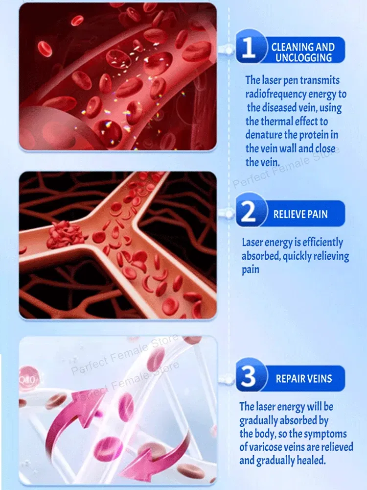 Color: Blue - Varicose Veins Products