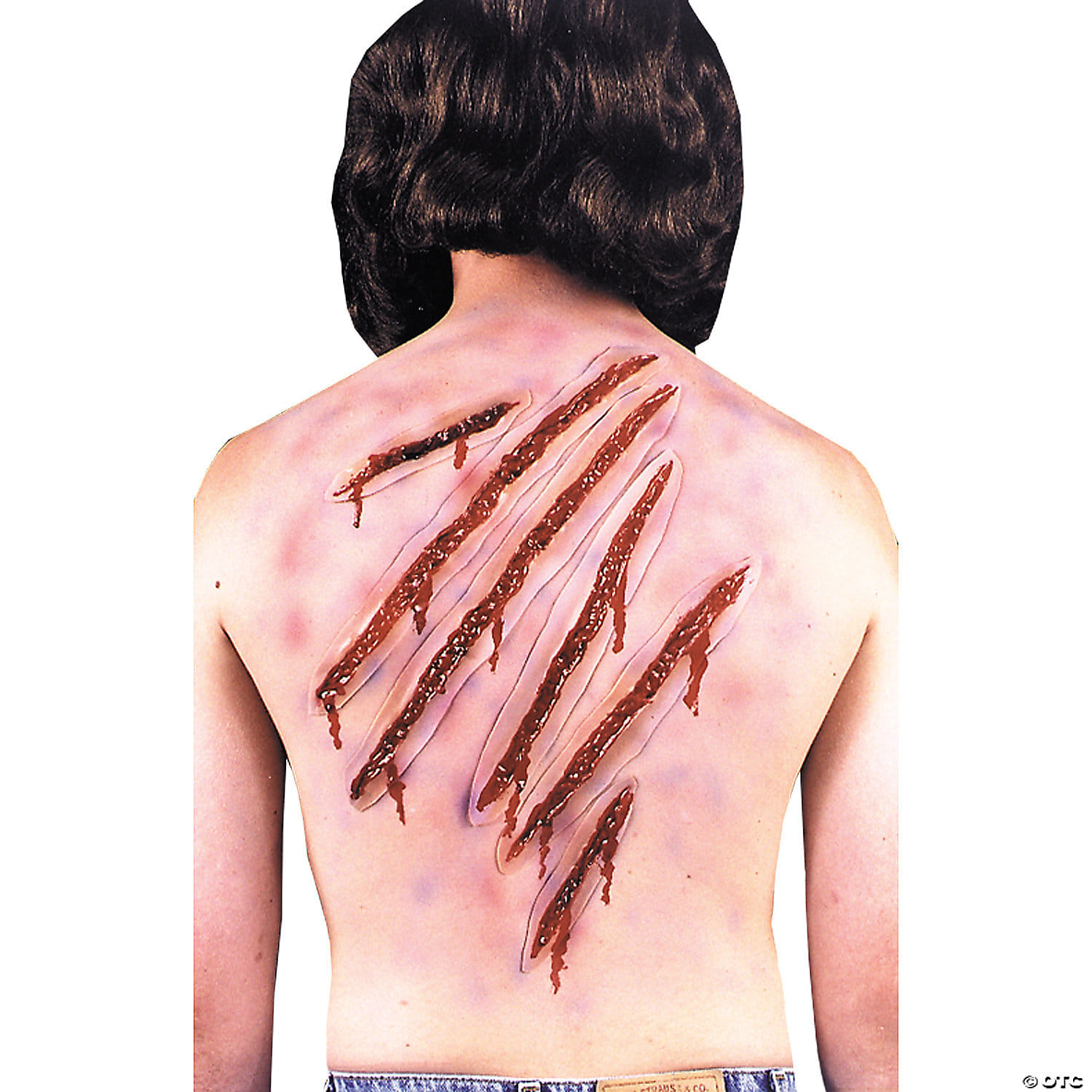 Nail scars