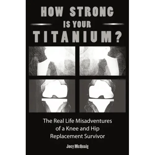 How Strong Is Your Titanium: The Real Life Misadventures of a Knee and Hip Replacement Survivor - Paperback