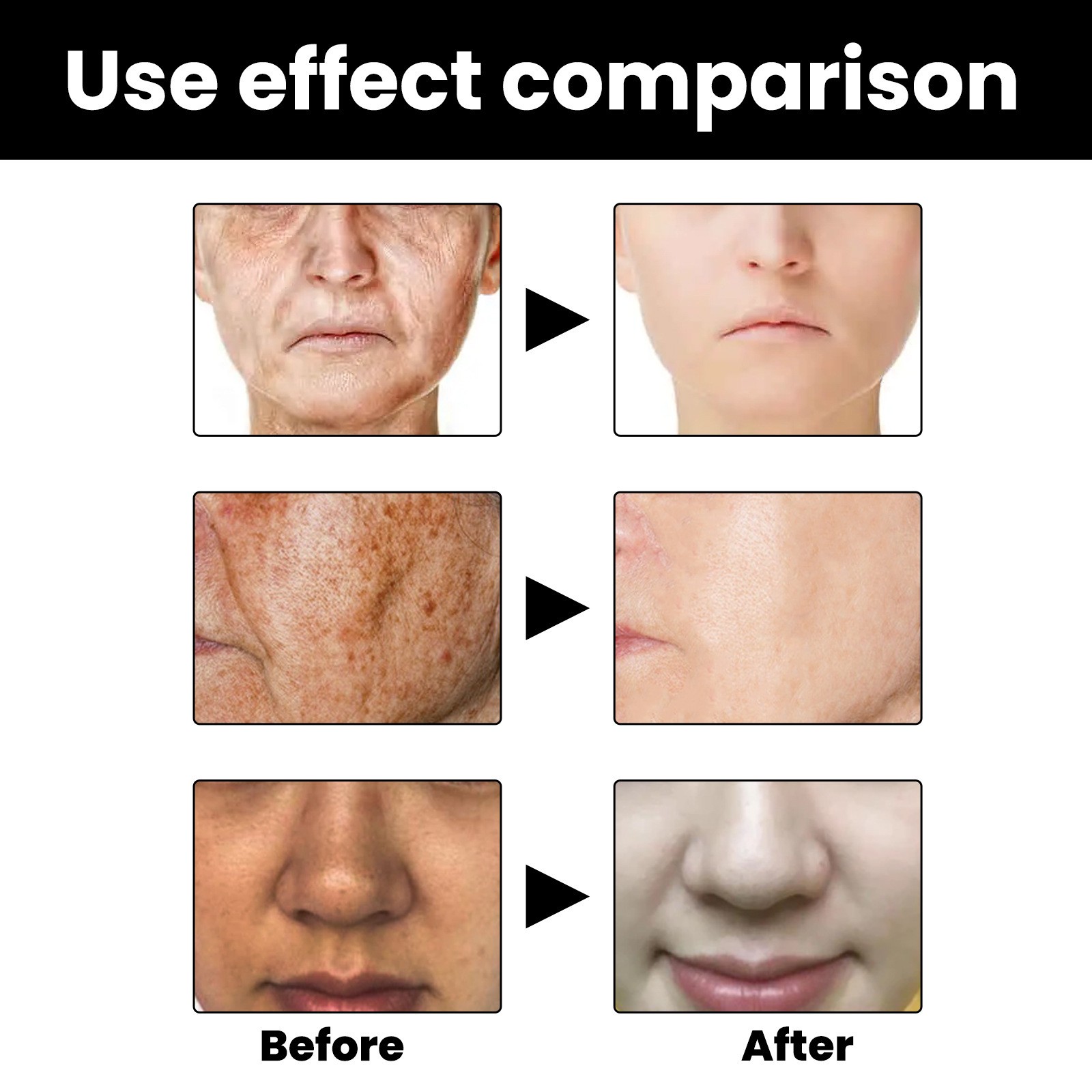 Whitening Freckle Serum