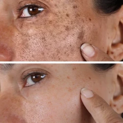 AQA™ Melanin Correcting Brightening Serum - Advanced Anti-Aging & Dark Spot Treatment