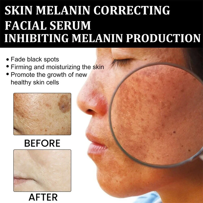 AQA™ Melanin Correcting Brightening Serum - Advanced Anti-Aging & Dark Spot Treatment