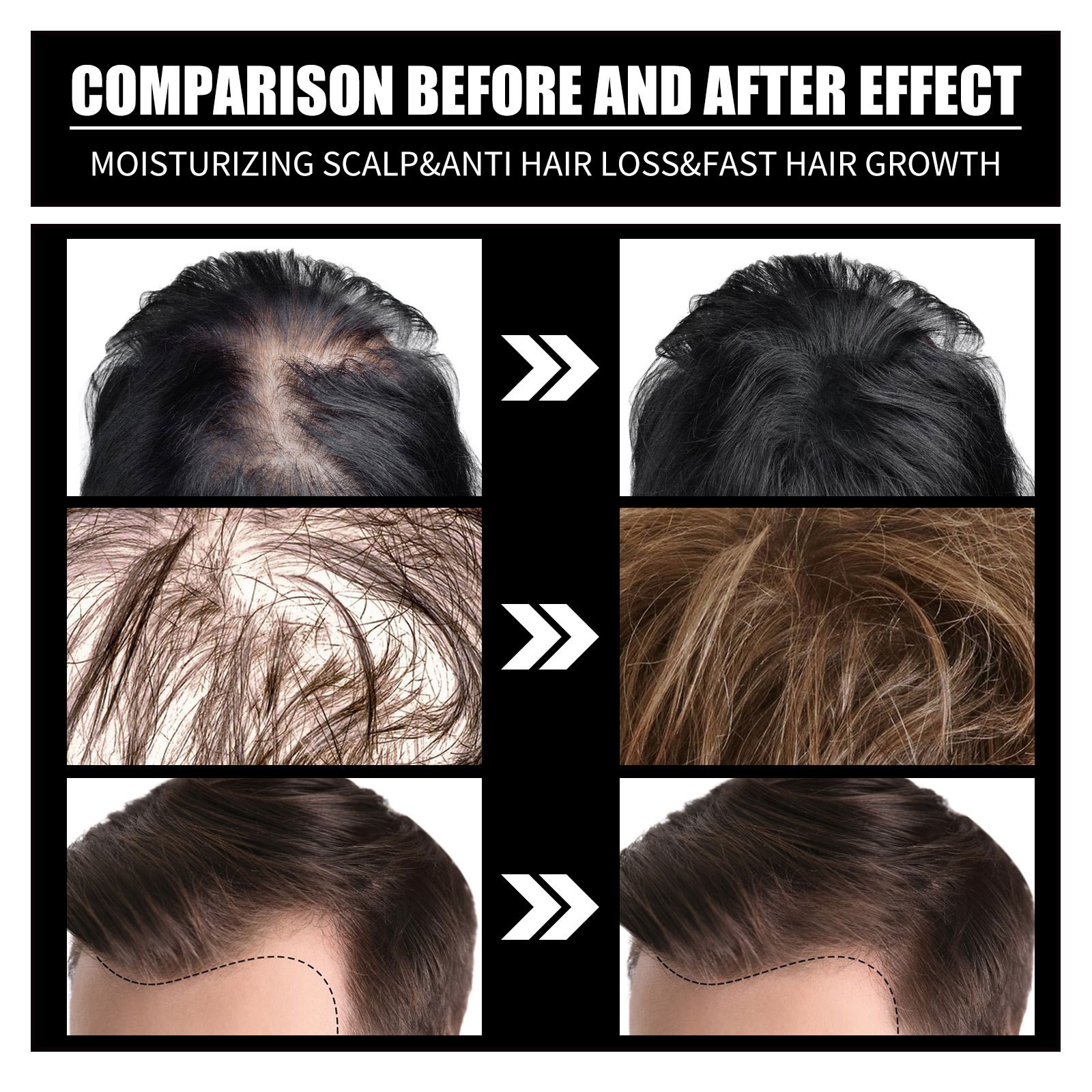 Biotin Fast Oil Hair Regrowth Serum - Anti-Hair Loss Treatment for Hair Thinning
