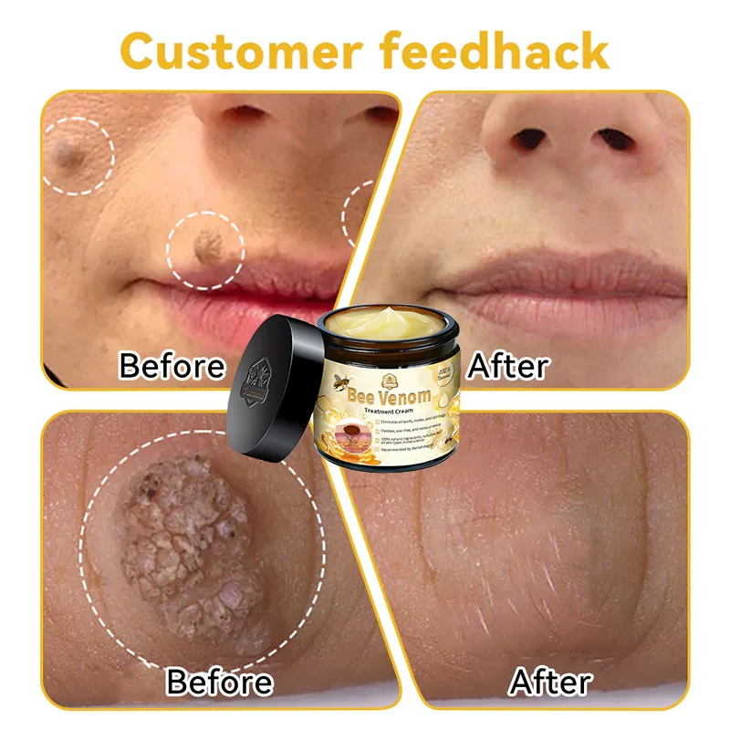 LOVILDS™ Bee Venom Skin Treatment Cream(Health Canada Approved)