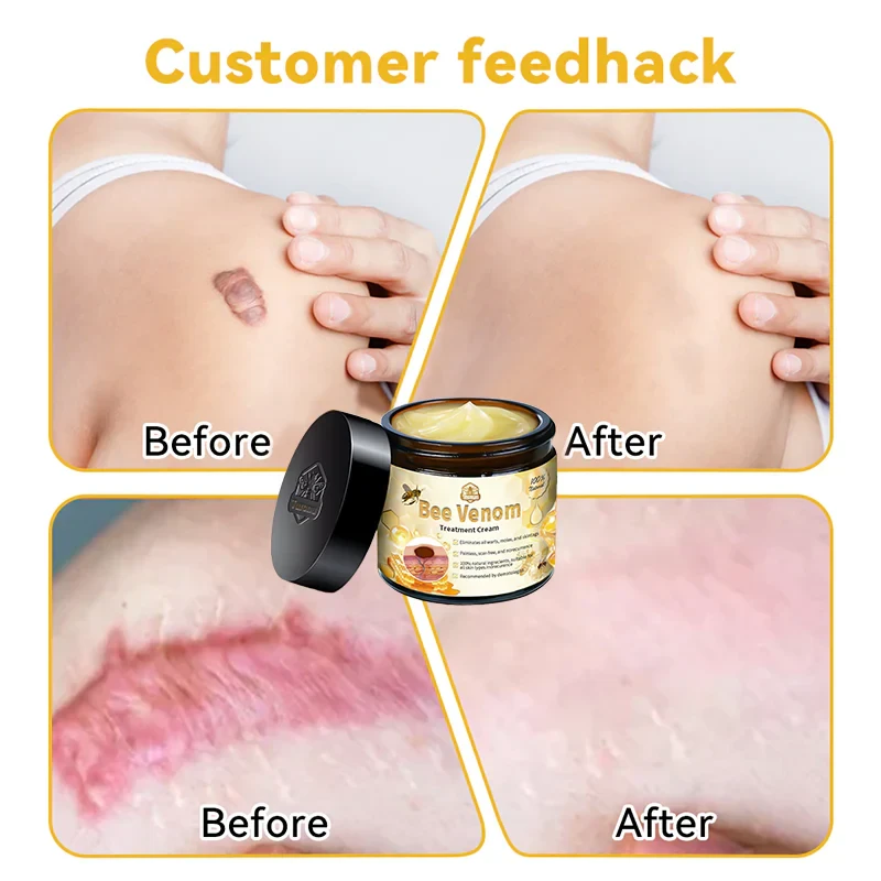 LOVILDS™ Bee Venom Skin Treatment Cream(Health Canada Approved)