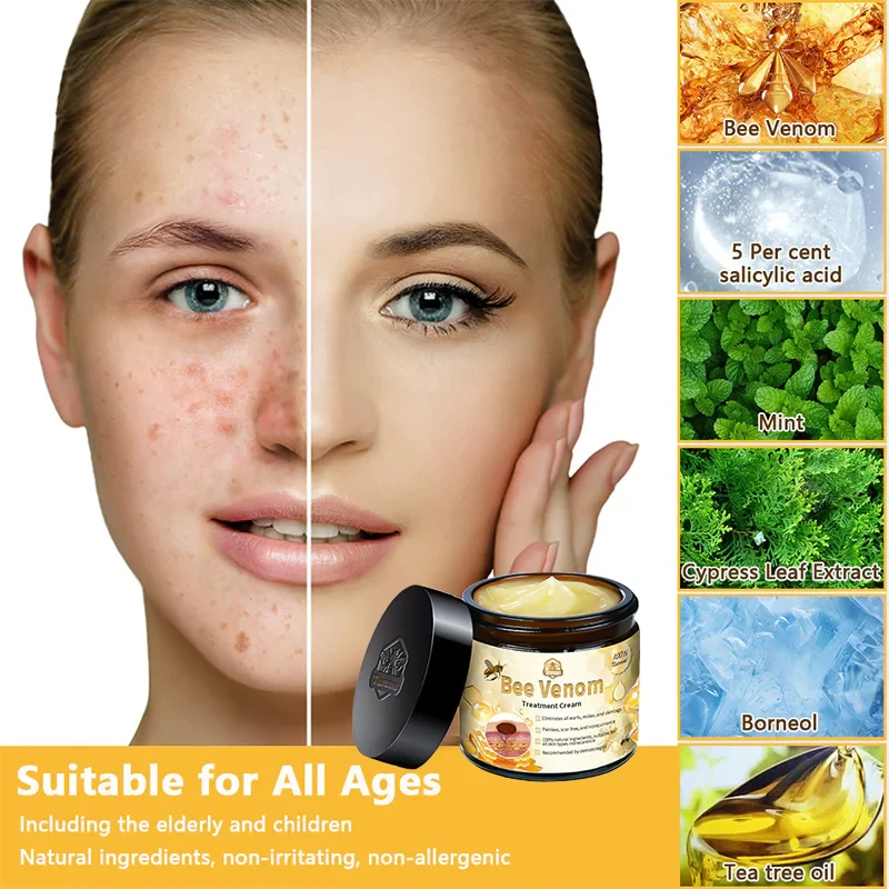 LOVILDS™ Bee Venom Skin Treatment Cream(Health Canada Approved)