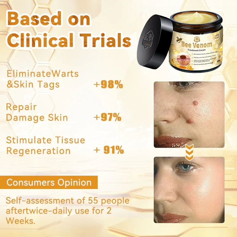 LOVILDS™ Bee Venom Skin Treatment Cream(Health Canada Approved)