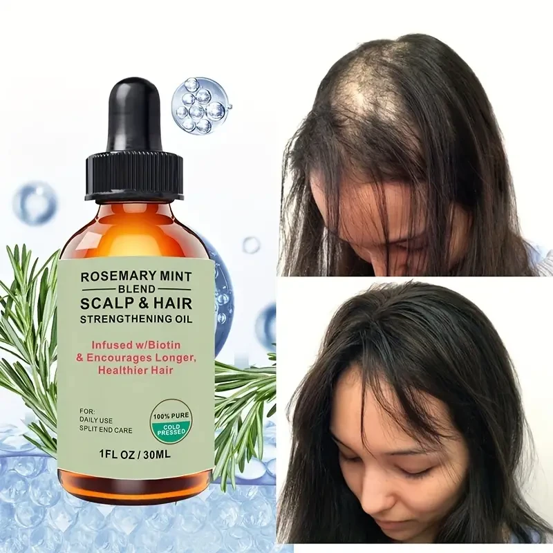 Rosemary Hair Growth Oil, Scalp And Hair Strengthening Oil For Hair Growth, Repair Dry, Damaged Hair, Restore Healthy Hair, Increase Shine, Contains Botanical Extracts, Hair Care Oil For All Hair Types.