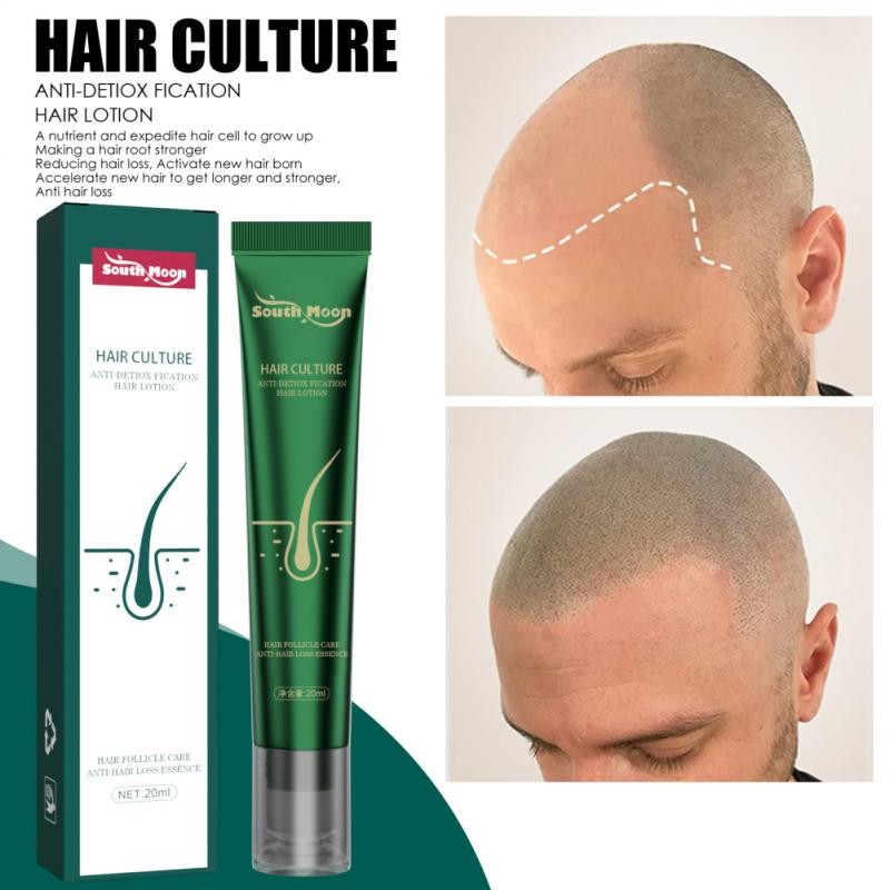 South Moon Anti-Hair Growth Essence - Strengthens Hair and Repairs Root Damage with Ginger Conditioning