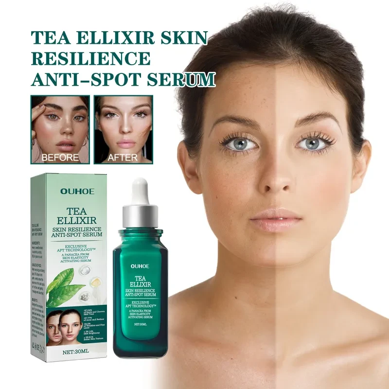 Melasma Blemish Moisturizing And Brightening Cream